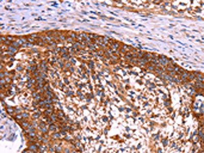 ABI1 Antibody