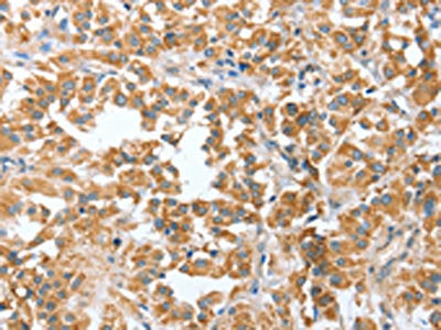 CIAPIN1 Antibody