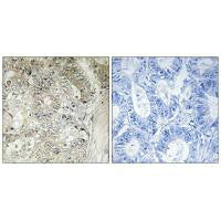 CST1 Antibody