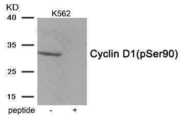 Phospho-CCND1 (Ser90) Antibody