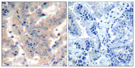 PIK3R1/PIK3R3 (Ab-467/199) Antibody