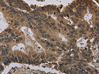 HIST1H4A Antibody