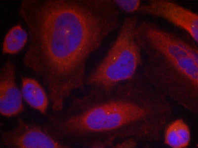 Phospho-SYT1 (Ser309) Antibody