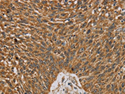 NDEL1 Antibody