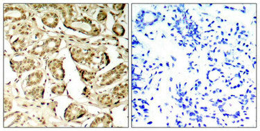 Phospho-MEF2A (Ser408) Antibody