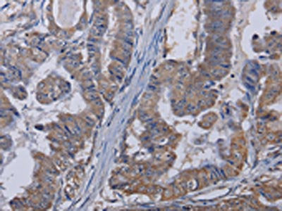TRPM8 Antibody