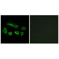 NT5C1B Antibody