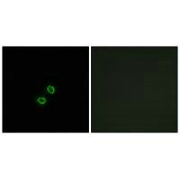 KIR2DL5B Antibody