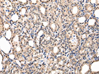 PPIL1 Antibody
