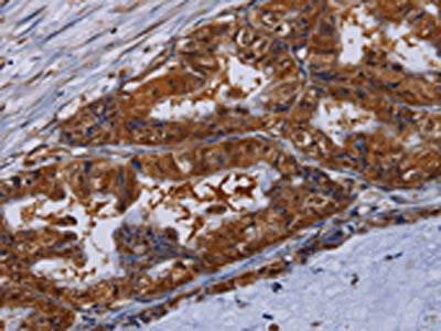 MFAP3L Antibody