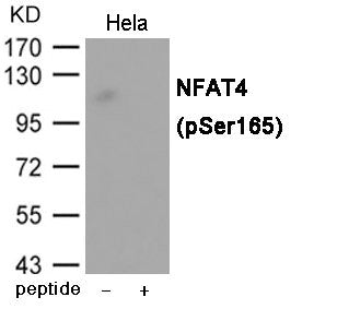 Phospho-NFATC3 (Ser165) Antibody