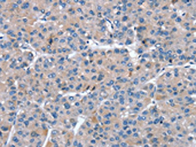 SNX27 Antibody