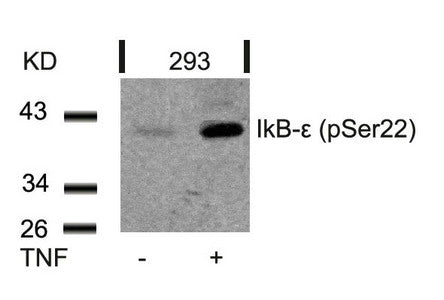 Phospho-NFKBIE (Ser22) Antibody