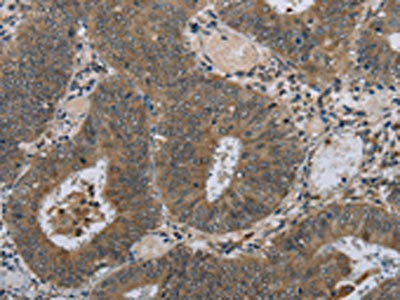 HSD3B1 Antibody
