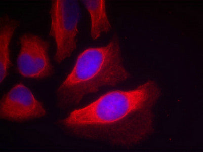 Phospho-IKBKB (Tyr199) Antibody