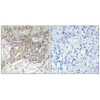 GCNT3 Antibody