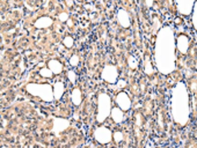 PPIL1 Antibody
