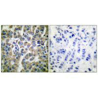HSPE1 Antibody