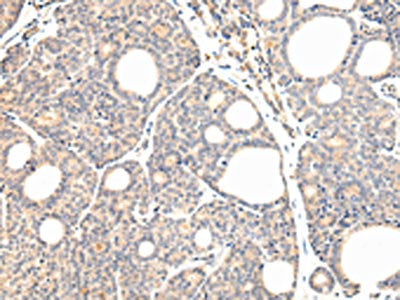 VPS28 Antibody