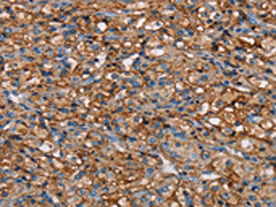 NEDD4L Antibody