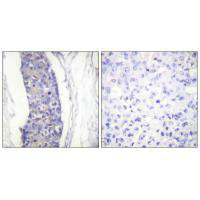 TUBA1A Antibody