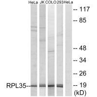 RPL35 Antibody