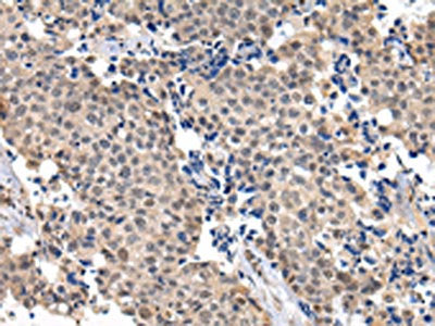 USF1 Antibody