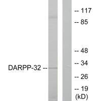 PPP1R1B Antibody