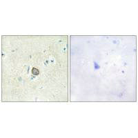 CELSR3 Antibody