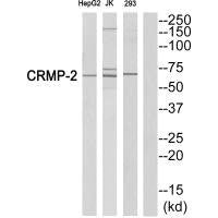 DPYSL2 (Ab-522) Antibody