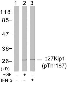 Phospho-CDKN1B (Thr187) Antibody