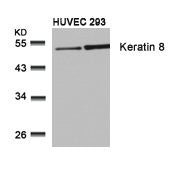 KRT8 (Ab-74) Antibody
