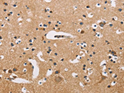 ATP2C1 Antibody