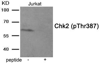 Phospho-CHEK2 (Thr387) Antibody