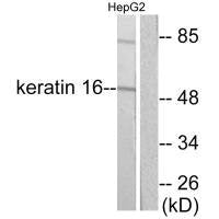 KRT16 Antibody