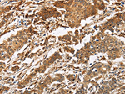 CALU Antibody