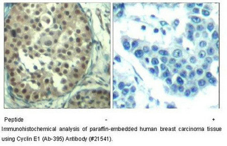 CCNE1 (Ab-395) Antibody