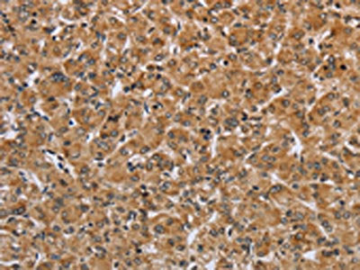 IKBKE Antibody