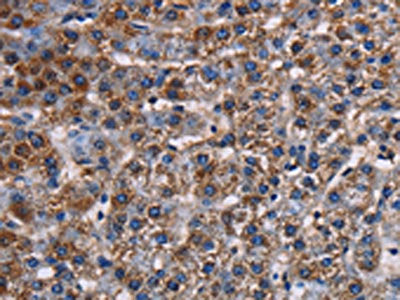 KCNK1 Antibody