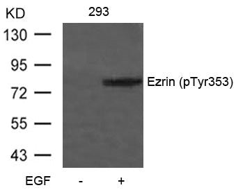 Phospho-EZR (Tyr353) Antibody