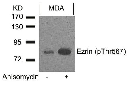 Phospho-EZR (Thr567) Antibody