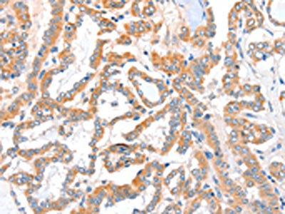 ACSBG1 Antibody