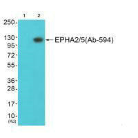 EPHA2/EPHA5 (Ab-594) Antibody