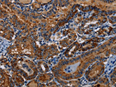 PIDD1 Antibody