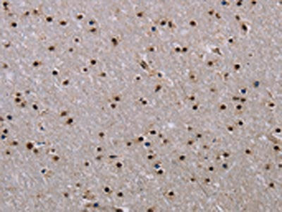 JMJD6 Antibody