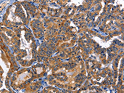 MUSK Antibody