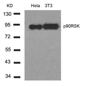 RPS6KA1 (Ab-348) Antibody