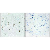 DCLK3 Antibody