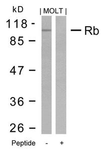 RB1 (Ab-795) Antibody