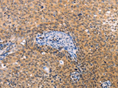 VHL Antibody